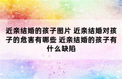 近亲结婚的孩子图片 近亲结婚对孩子的危害有哪些 近亲结婚的孩子有什么缺陷